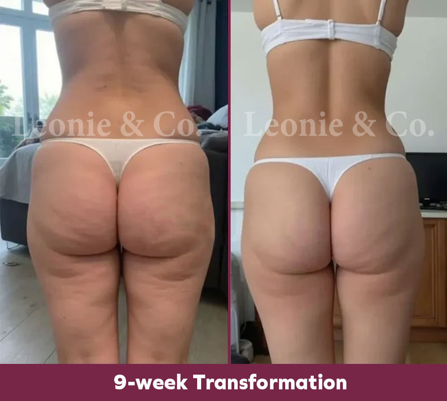 Hannah (31 yrs)